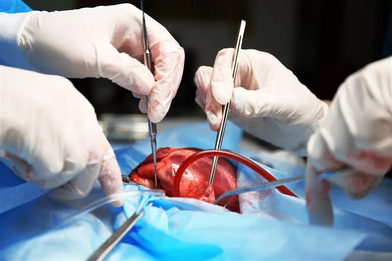 adult-congential-heart-disease-surgery